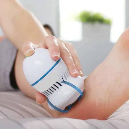Radiant Glow Co™ Vacuum Callus Remover
